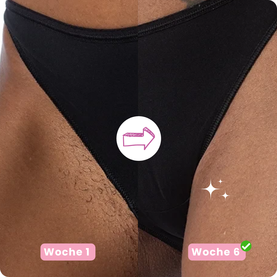 IPL PRO 4 Haarentfernungsgerät